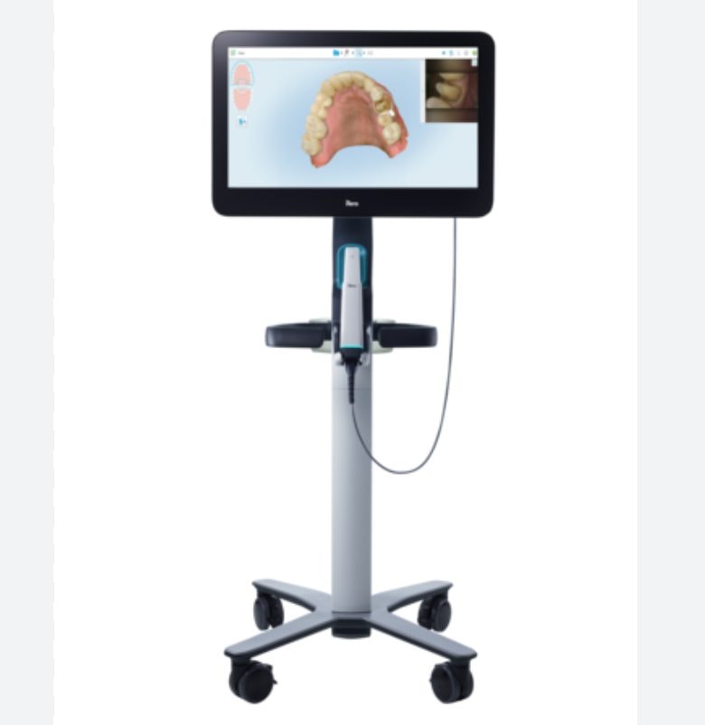 iTero digital scanner showing a 3D tooth scan